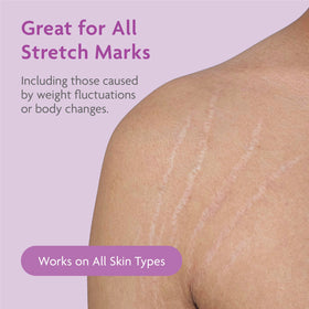 TriLASTIN skin hydration detail showing creamy texture.