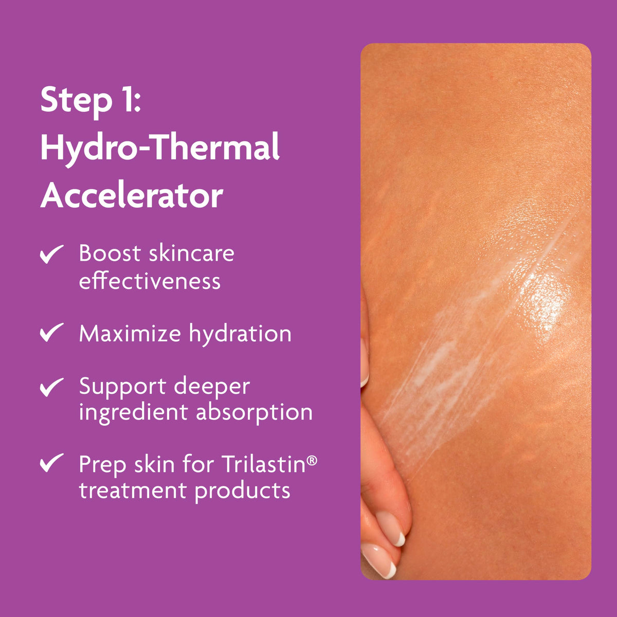 TriLASTIN stretch-mark cream bottle close-up highlighting hydration.