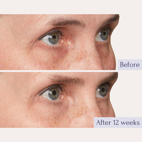 Tru Alchemy Eye Elixir Hyaluronix plump under-eye skin