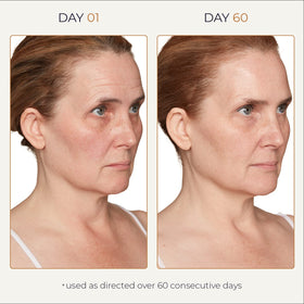 Tru Alchemy Spot Check on the face for even tone during application