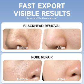 TrySafe hyaluronic hydration shot: delivers surface moisture for a refreshed feel