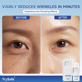 TrySafe kojic acid brightening close-up suggests even-toned under-eyes