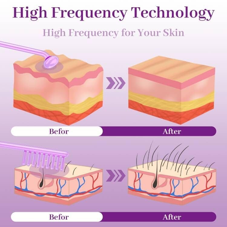 TUMAKOU Violet mushroom attachment for larger facial areas.