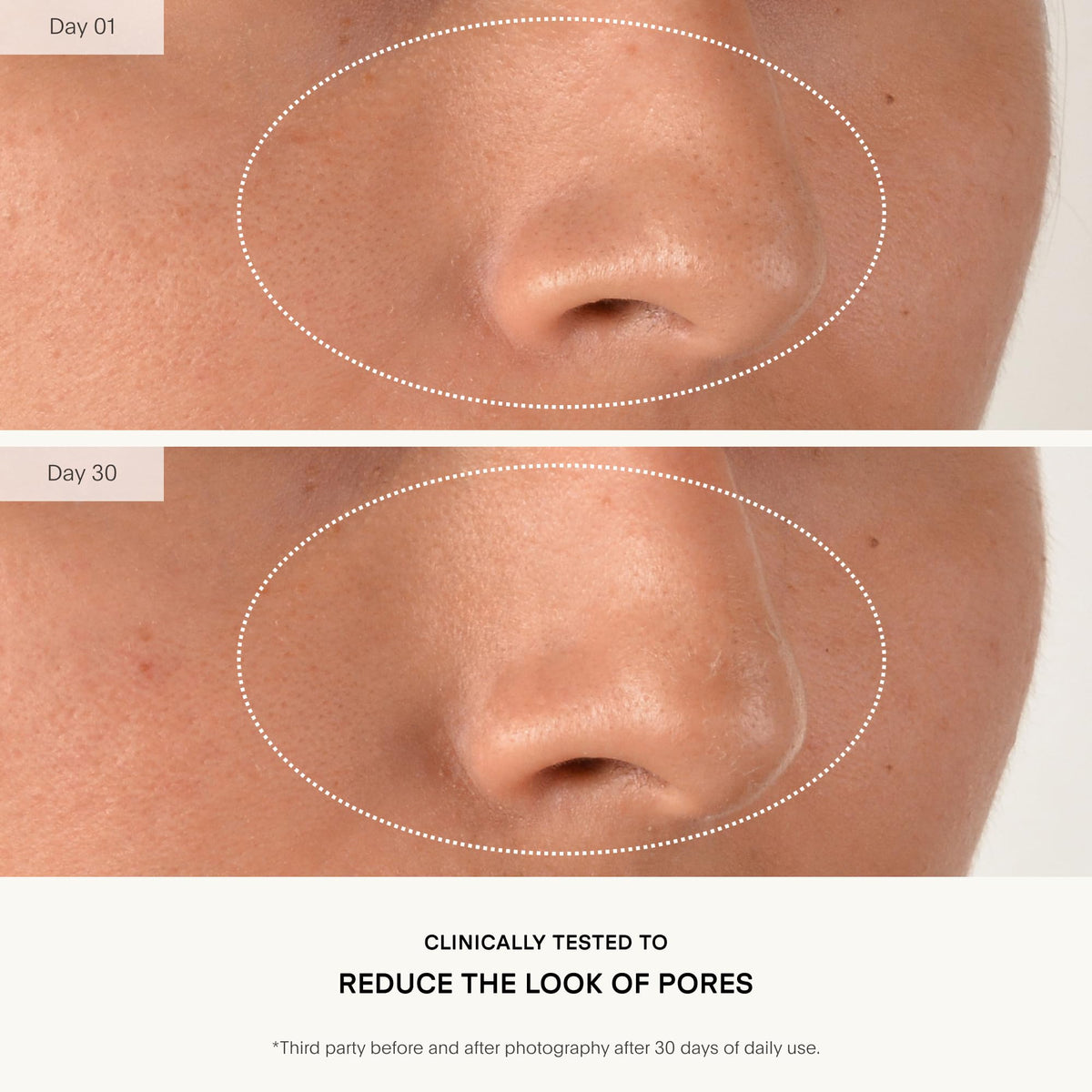 U Beauty Resurfacing Compound Serum with vitamin C imagery suggesting brightening effects.