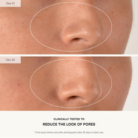 U Beauty Resurfacing Compound Serum with vitamin C imagery suggesting brightening effects.