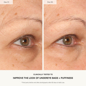 U Beauty The RETURN Eye Concentrate applied under-eye helps refresh and smooth tired-looking skin.