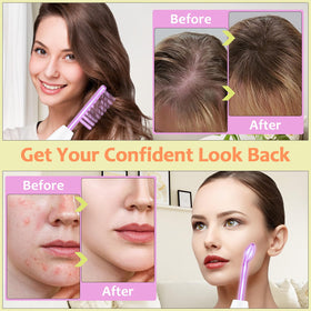 Uaike indirect method for gentle, non contact treatment at home