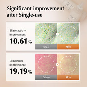 UIQ Biome Barrier Cream Mist enriched with HA for plump skin.