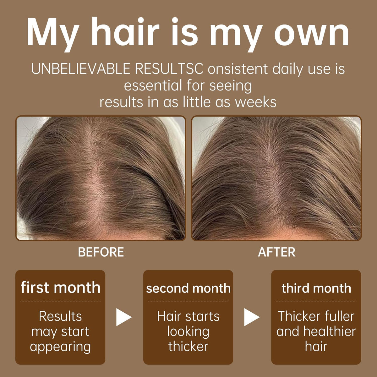 Scalp massage with Uizelta Batana Oil for moisture