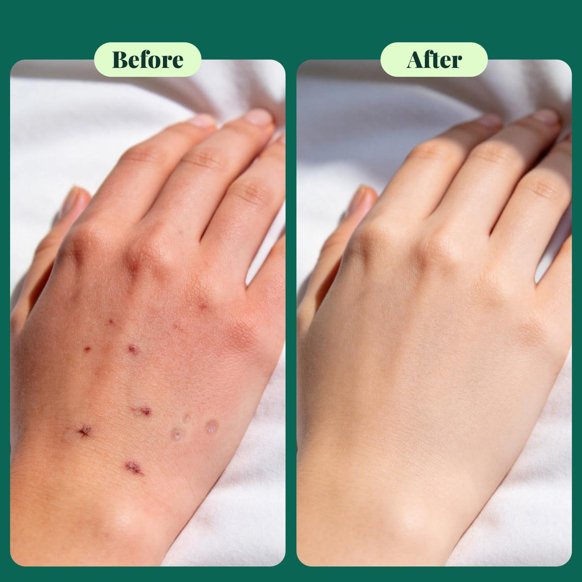 Texture close-up shows lightweight, non-greasy hydration for sensitive skin.