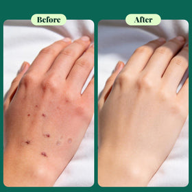 Texture close-up shows lightweight, non-greasy hydration for sensitive skin.