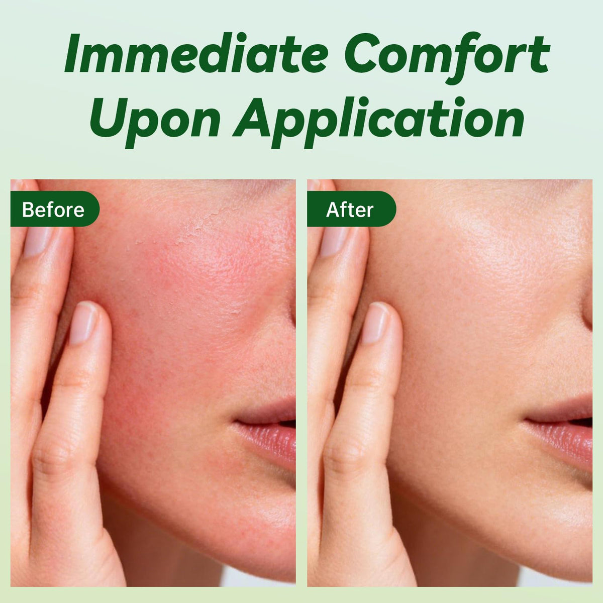 Close-up of ULARCS Triamicinolona Cream texture showing quick-absorbing, non-sticky feel.