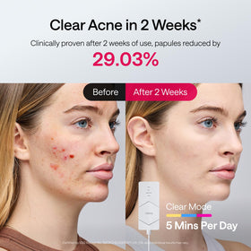Ulike Reglow four modes graphic highlighting Glow, Firm, Rejuvenate and Clear