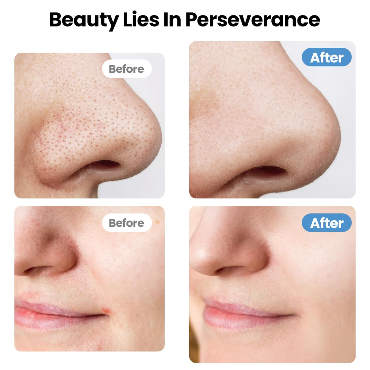UNIWA Skin Scrubber lifting mode provides gentle facial massage.