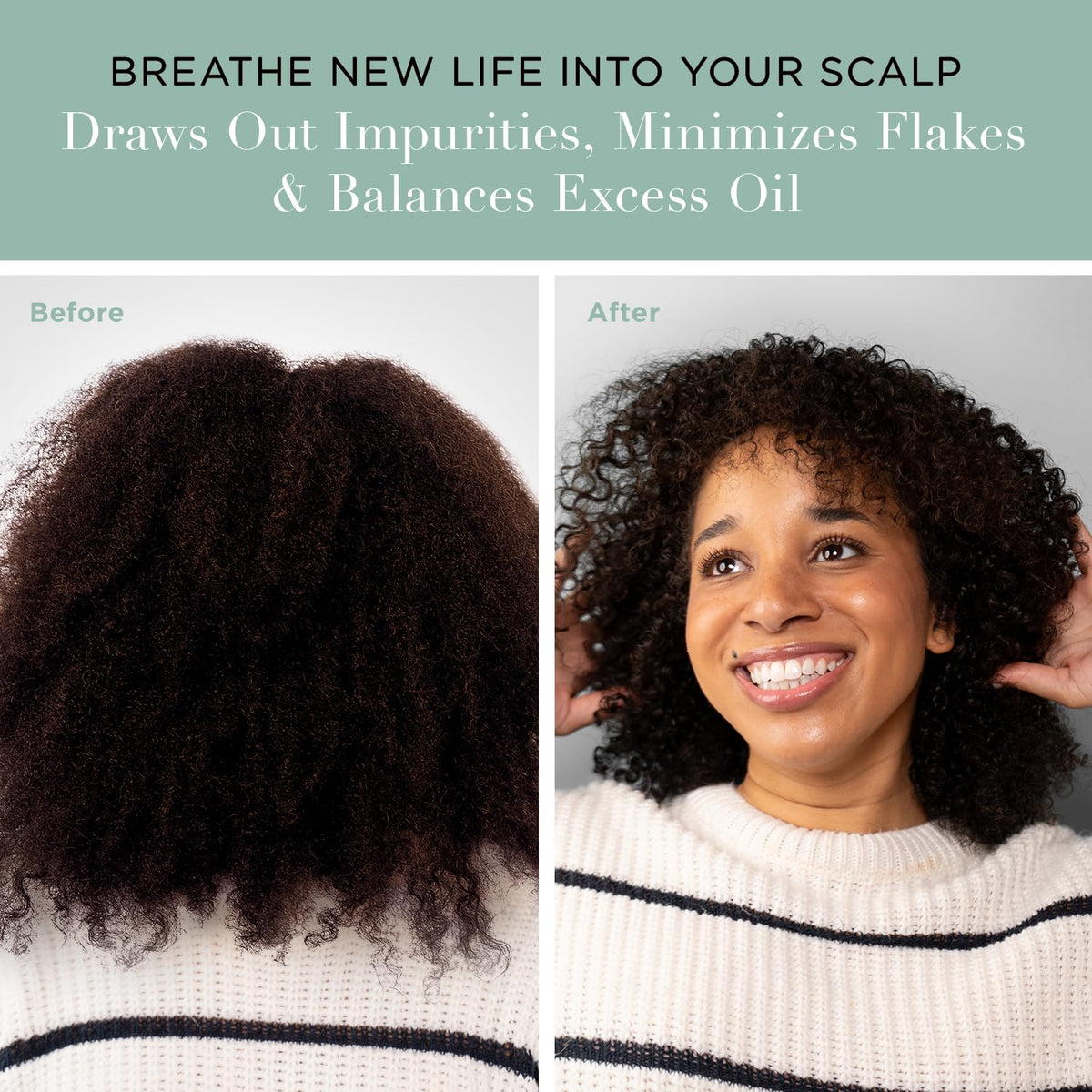 Unwash Charcoal Detox Scrub hydration infusion nourishes dry scalp after use.