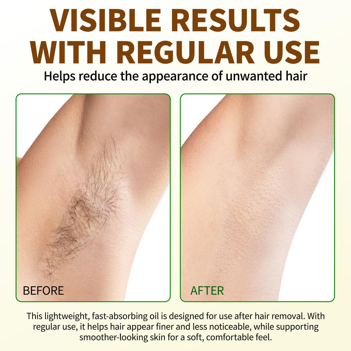 Uocasi Cyperus Rotundus Oil bottle resting on a skin-care setup after hair removal.