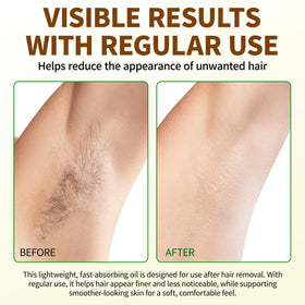 Uocasi Cyperus Rotundus Oil bottle resting on a skin-care setup after hair removal.