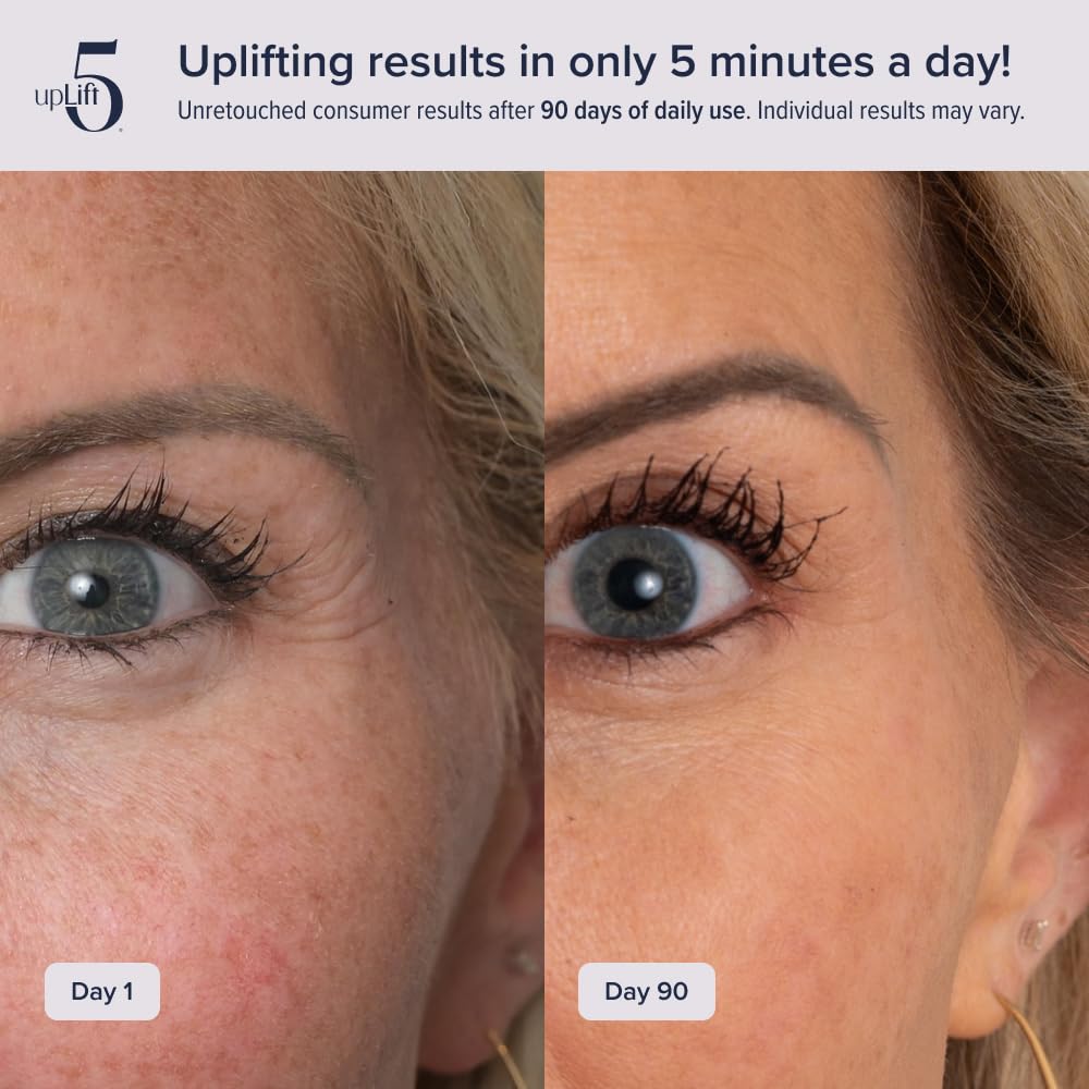 upLift 5 mouthpiece usage action demonstrating at-home non-invasive lift