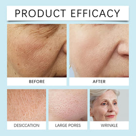 URABOS Zombie Face Mask result shot hints smoother, refreshed skin after use