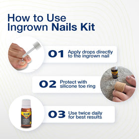 URIEL gentle non-invasive toe care for at-home use