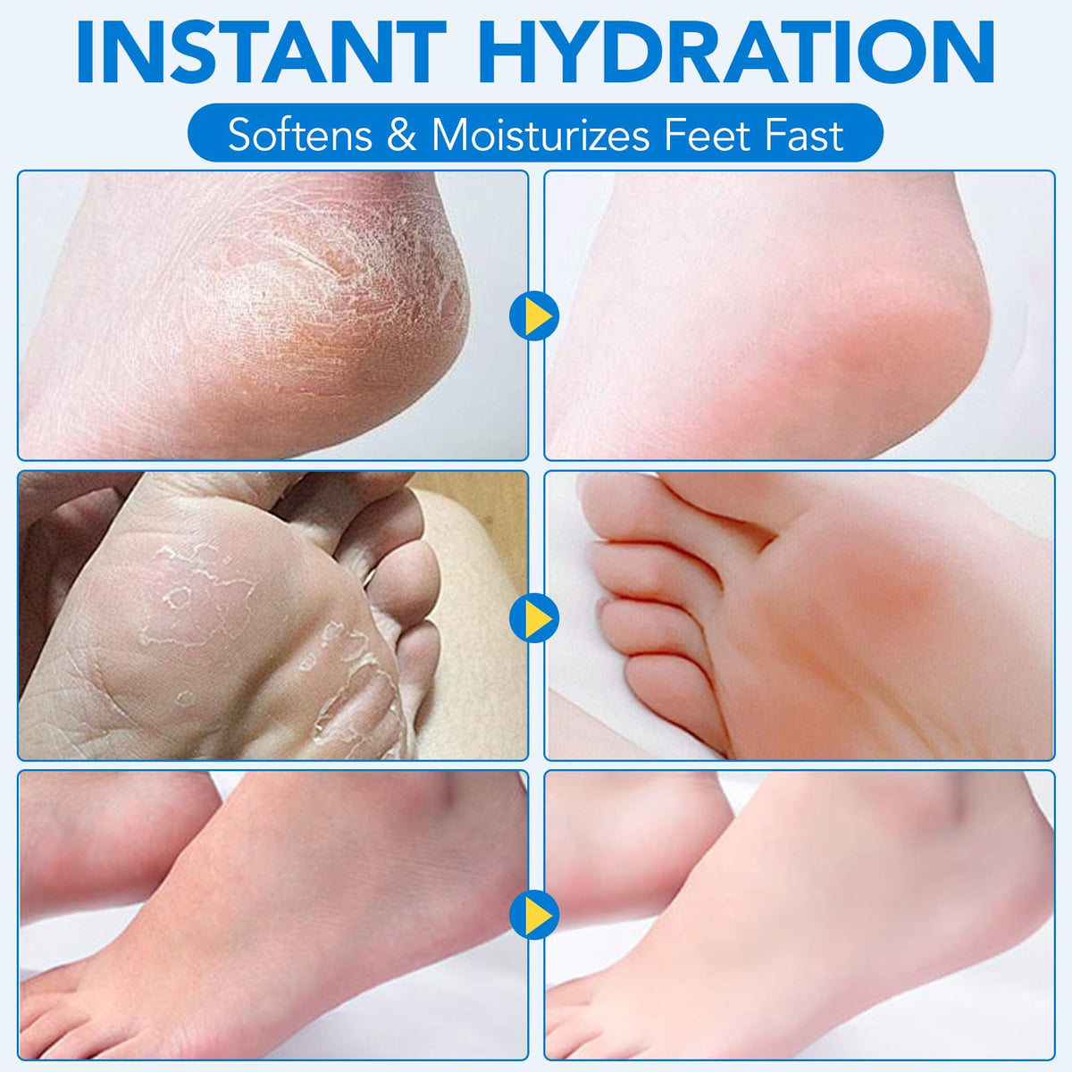 Uruses Stick design for targeted foot care