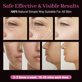 UUPAS tongue tube for precise application on small facial zones