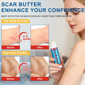 UXENPHXF Scar Butter Stick for face and body care