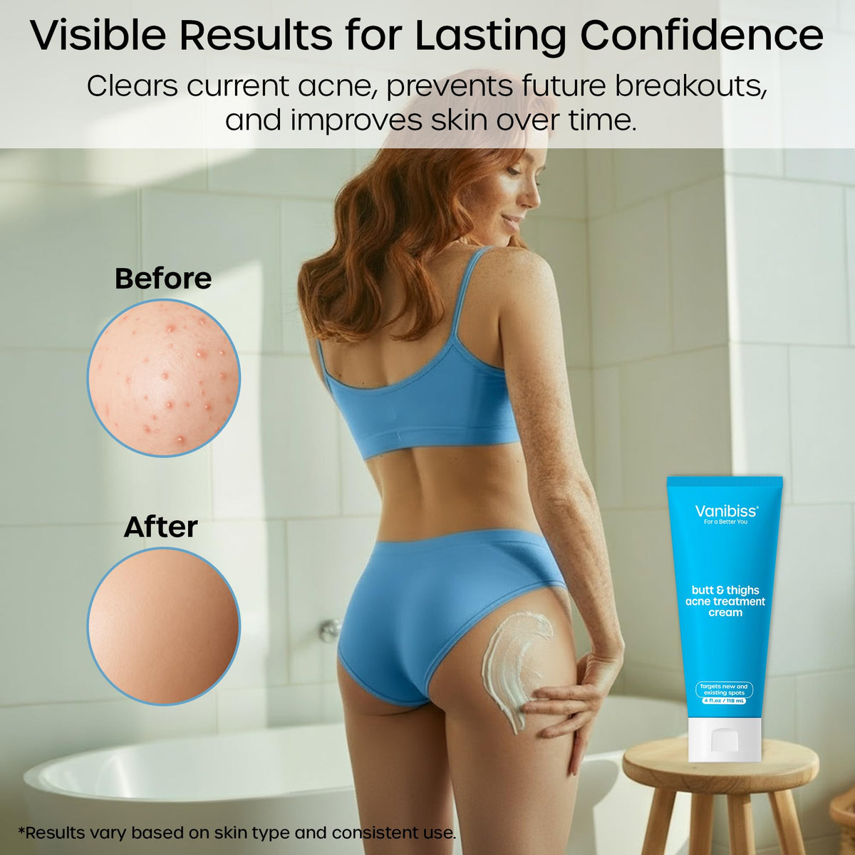 Vanibiss dark spot fade progress image emphasizes evening tone over time.