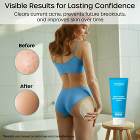 Vanibiss dark spot fade progress image emphasizes evening tone over time.