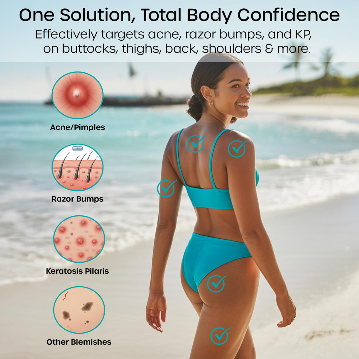 Vanibiss thighs acne solution application demonstrates versatile use across body areas.