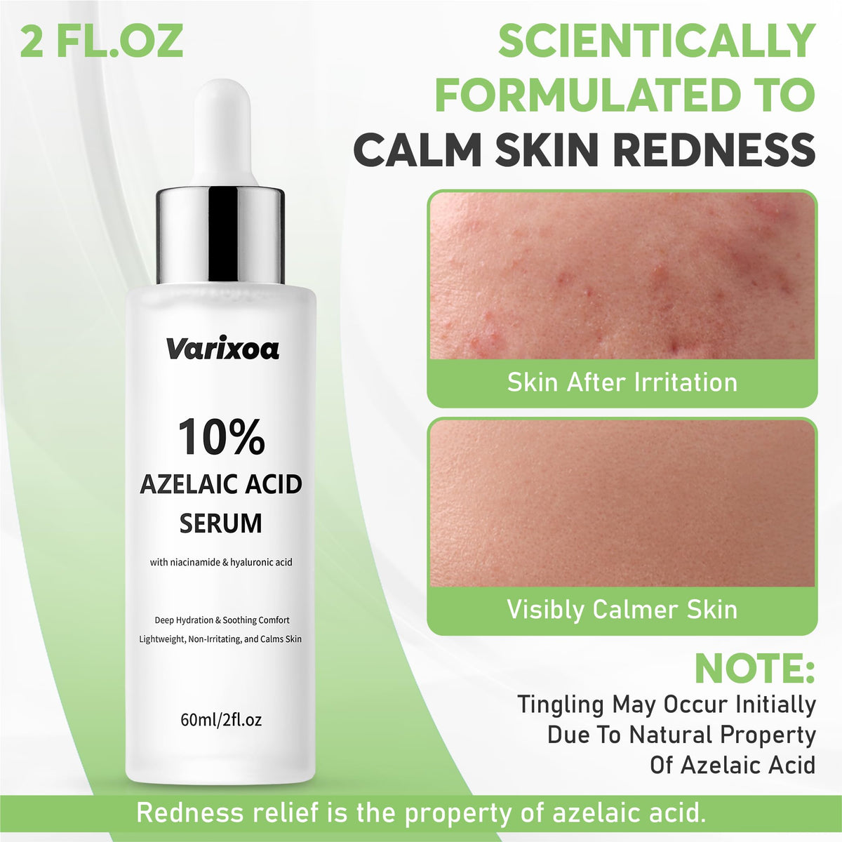Varixoa with Niacinamide and Hyaluronic Acid supports hydration and balanced skin