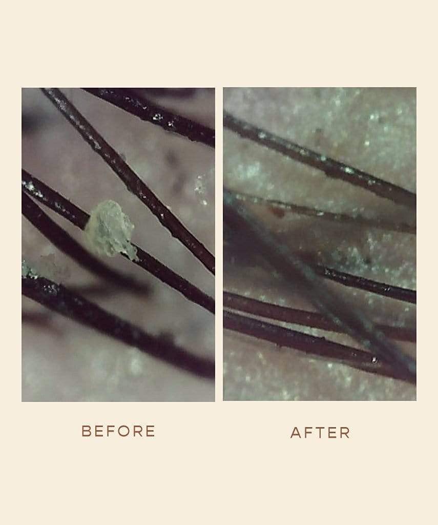 Fresh citrus scent of VEGAMOUR GRO Scalp Detoxifying Serum bottle aroma.