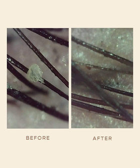 Fresh citrus scent of VEGAMOUR GRO Scalp Detoxifying Serum bottle aroma.