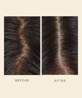 Willowherb extract as a key ingredient for scalp balance.