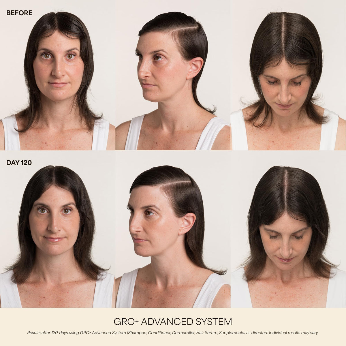 VEGAMOUR GRO+ at-home scalp therapy for daily care.
