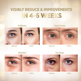 VELAMO ADVANCED Wrinkle Smoothing Eye Patches soften crow's feet and firm skin.