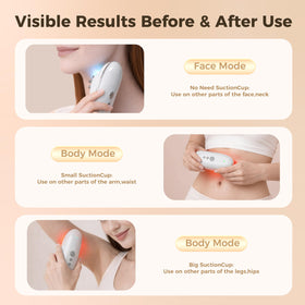 Velanoraga 5-in-1 face mode close-up for facial lift and smoothing