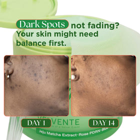 Dense foam cleanses pores without drying the skin