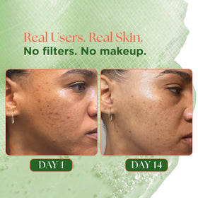 Closeup of rose PDRN formula foam for calm cleansing
