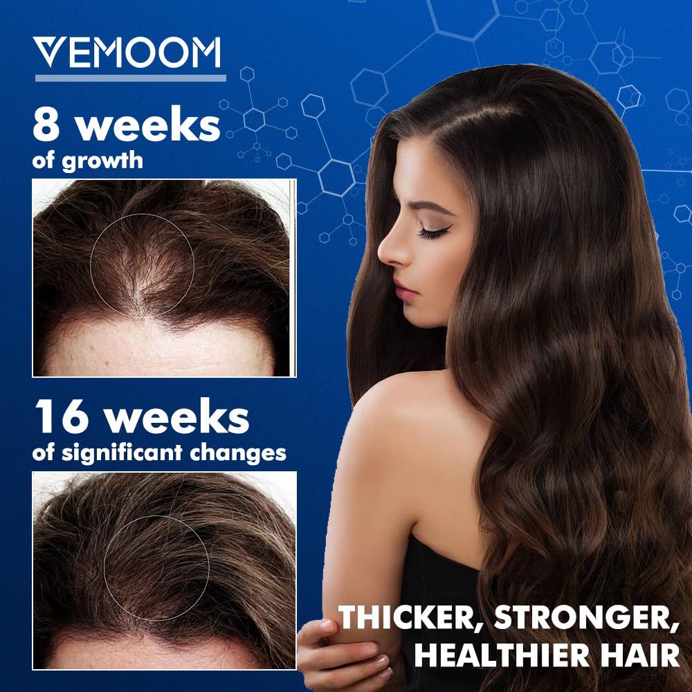 VEMOOM dense-hair visual hints at improved density