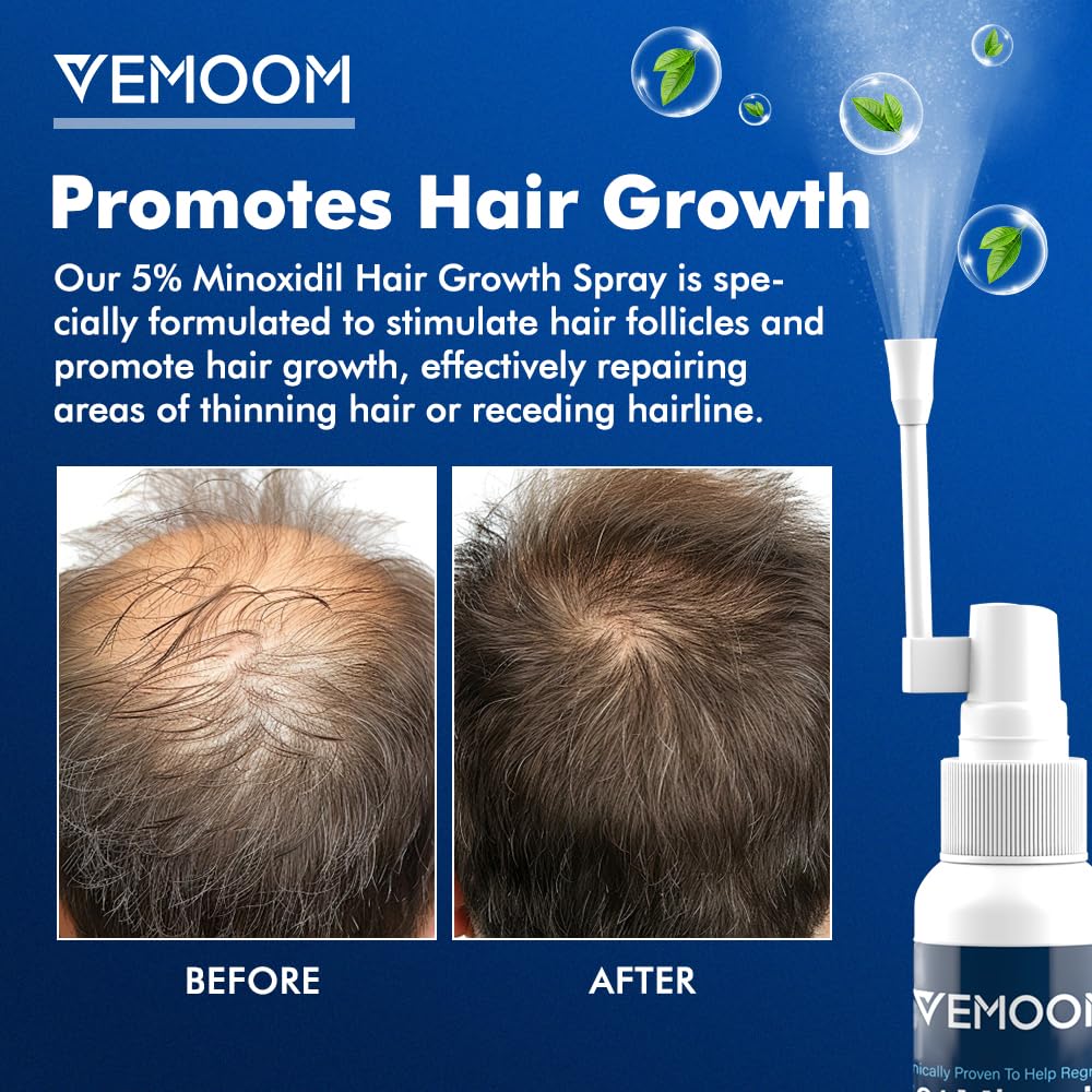 VEMOOM Minoxidil spray mist showing easy, even distribution