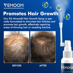 VEMOOM Minoxidil spray mist showing easy, even distribution