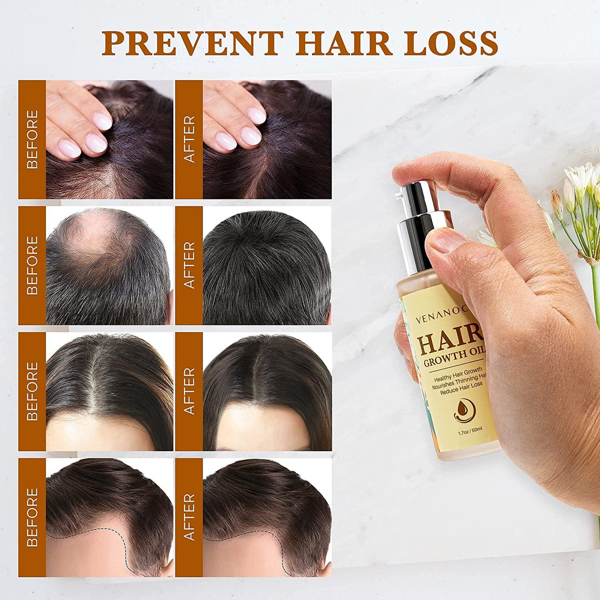 Venanoci hair growth oil dropper dispensing small amount for scalp use