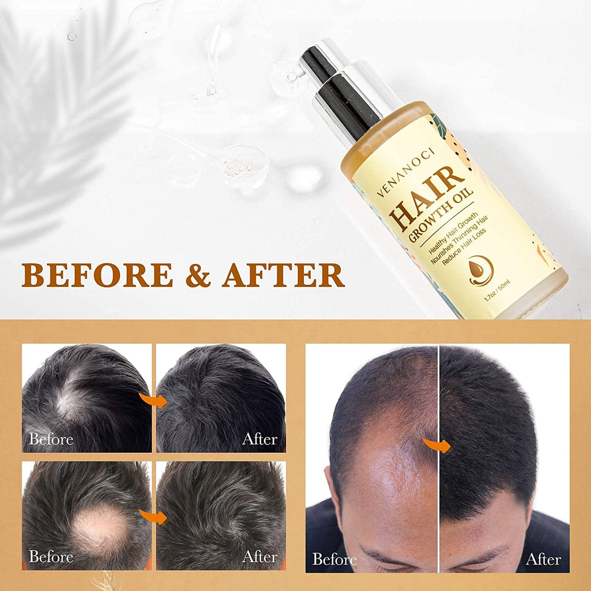 Venanoci two-pack of hair growth oil packaging on display