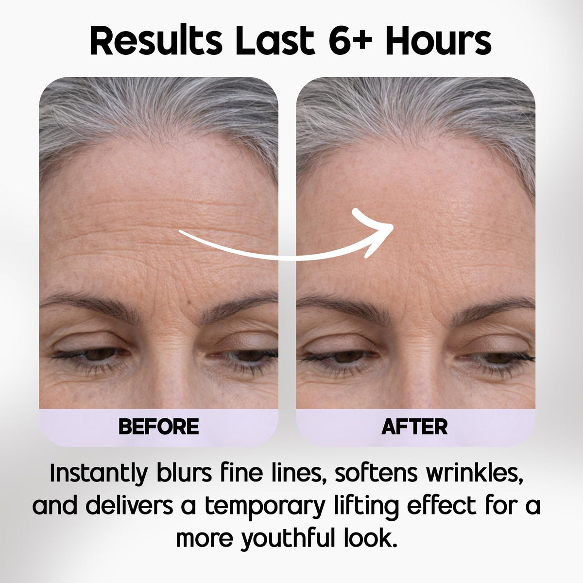 Venofye Blossom Bee Advanced Wrinkle Corrector on forehead and mouth lines shows smoothing.