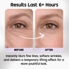 Venofye Blossom Bee Advanced Wrinkle Corrector under-eye area application shows smoothing.