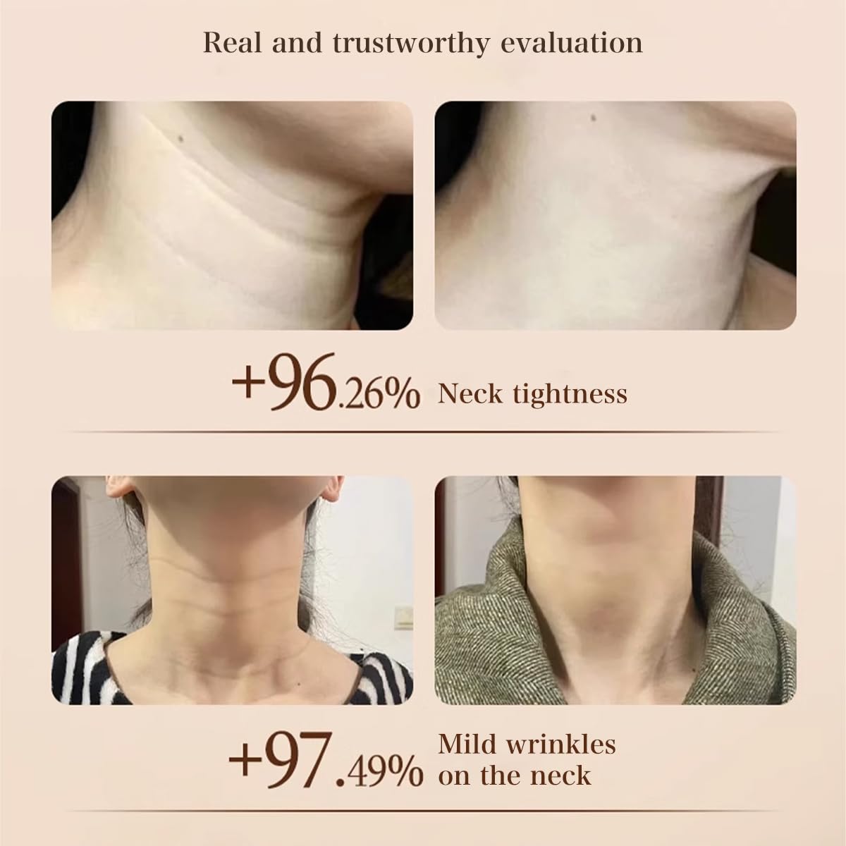 Venrock Niacinamide Neck Cream close-up texture suggests rich yet lightweight feel