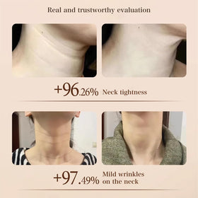 Venrock Niacinamide Neck Cream close-up texture suggests rich yet lightweight feel