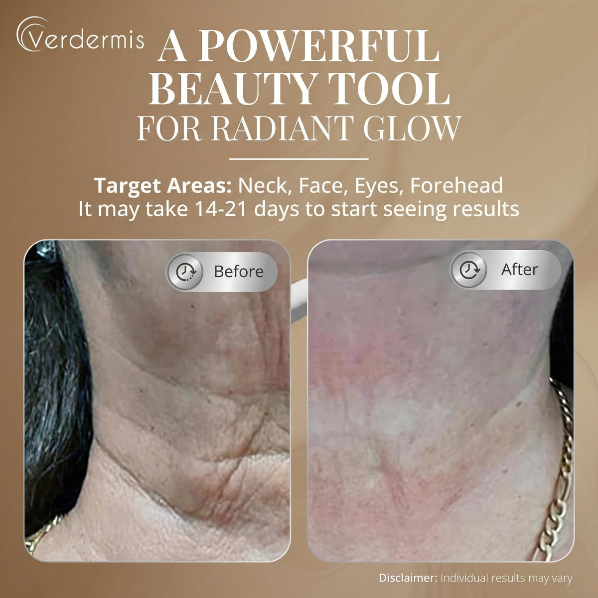 VERDERMIS triple-mode red light therapy closeup highlights versatile skincare sessions.