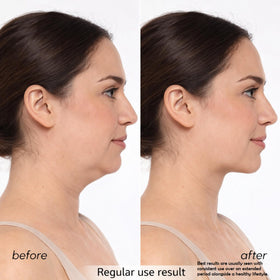 Versha V-Face Machine with 8 modes for customizable skincare sessions